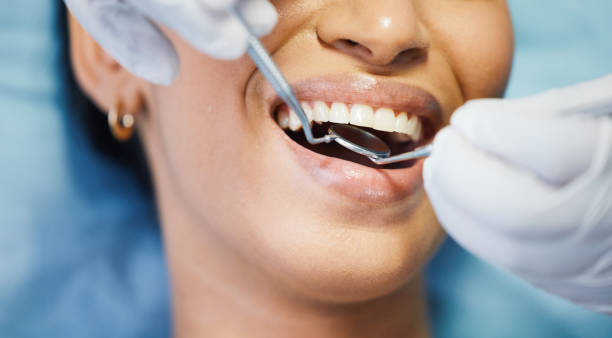 Best Emergency Treatment for Oral Infections in La Grange, IL